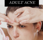 Suffering from acne as an adult? Here's what to do